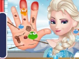 flash игра Elsa. Hand doctor