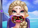flash игра Elsa throat doctor